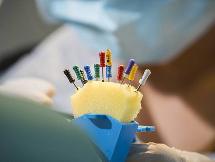 Endodonti Post Nedir?