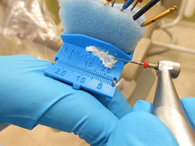 Endodonti Endokron Nedir?